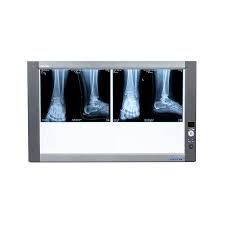 X Ray Viewer